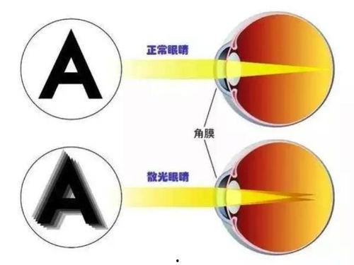 成人散光测量方法视频,成人散光测量方法视频教程概述
