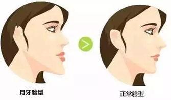 成人斜眼外观矫正视频,视频揭秘成人外观改善之旅
